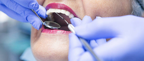 Best Urgent Dental Care in Watsonville, CA